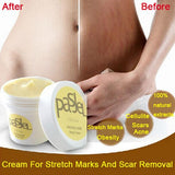 Pasjel Scar Removal and Stretch Mark Cream - BabyBloomPlace